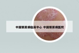 中国银屑病临床中心 中国银屑病医院