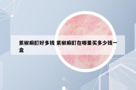 紫椒癣酊好多钱 紫椒癣酊在哪里买多少钱一盒