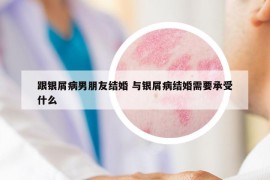 跟银屑病男朋友结婚 与银屑病结婚需要承受什么