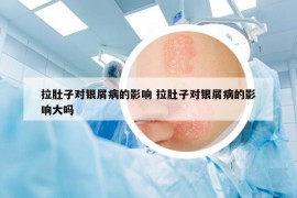 拉肚子对银屑病的影响 拉肚子对银屑病的影响大吗