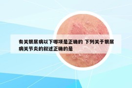 有关银屑病以下哪项是正确的 下列关于银屑病关节炎的叙述正确的是