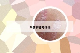 牛皮癣能吃樱桃