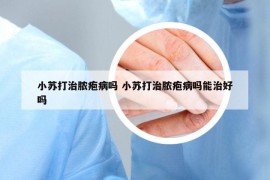 小苏打治脓疱病吗 小苏打治脓疱病吗能治好吗