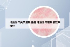 汗蒸治疗关节型银屑病 汗蒸治疗银屑病效果很好