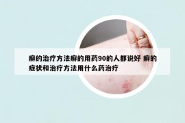 癣的治疗方法癣的用药90的人都说好 癣的症状和治疗方法用什么药治疗