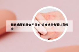 银肖病要记什么不能吃 银肖病患者要注意哪些