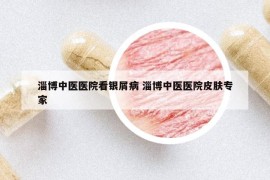 淄博中医医院看银屑病 淄博中医医院皮肤专家