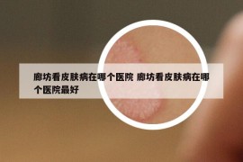 廊坊看皮肤病在哪个医院 廊坊看皮肤病在哪个医院最好