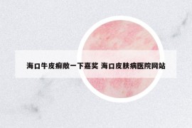 海口牛皮癣敞一下嘉奖 海口皮肤病医院网站