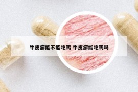 牛皮癣能不能吃鸭 牛皮癣能吃鸭吗
