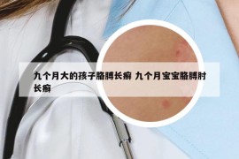 九个月大的孩子胳膊长癣 九个月宝宝胳膊肘长癣