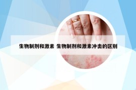 生物制剂和激素 生物制剂和激素冲击的区别