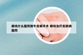 廊坊什么医院做牛皮癣手术 廊坊治疗皮肤病医院