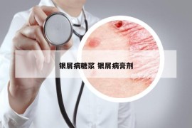 银屑病糖浆 银屑病膏剂
