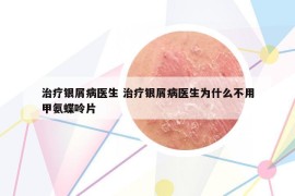 治疗银屑病医生 治疗银屑病医生为什么不用甲氨蝶呤片