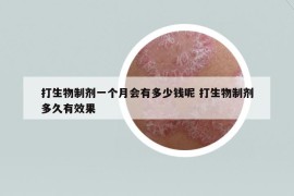 打生物制剂一个月会有多少钱呢 打生物制剂多久有效果