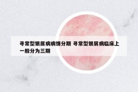 寻常型银屑病病情分期 寻常型银屑病临床上一般分为三期