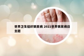 世界卫生组织银屑病 2021世界银屑病日主题