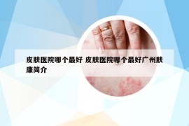 皮肤医院哪个最好 皮肤医院哪个最好广州肤康简介