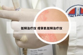 低频治疗仪 痉挛肌低频治疗仪