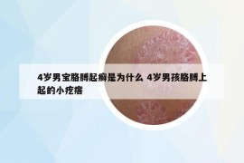 4岁男宝胳膊起癣是为什么 4岁男孩胳膊上起的小疙瘩
