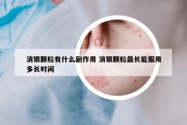 消银颗粒有什么副作用 消银颗粒最长能服用多长时间