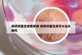 修研抑菌洗液银屑病 修研抑菌洗液可以治头癣吗