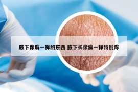 腋下像癣一样的东西 腋下长像癣一样特别痒