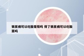 银屑病可以吃酸葡萄吗 得了银屑病可以吃酸菜吗