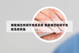 银屑病怎样调节免疫系统 银屑病怎样调节免疫系统恢复