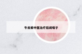 牛皮癣中医治疗后闹嗓子