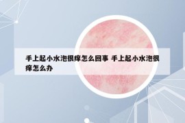 手上起小水泡很痒怎么回事 手上起小水泡很痒怎么办
