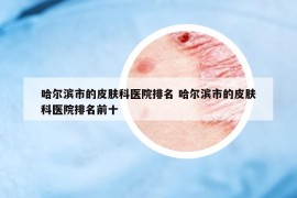 哈尔滨市的皮肤科医院排名 哈尔滨市的皮肤科医院排名前十