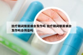放疗期间银屑病会发作吗 放疗期间银屑病会发作吗会传染吗
