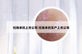 托珠单抗上市公司 托珠单抗生产上市公司