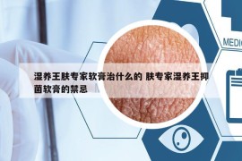 湿养王肤专家软膏治什么的 肤专家湿养王抑菌软膏的禁忌
