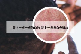 背上一点一点的白的 背上一点点白色斑块