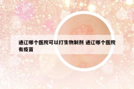 通辽哪个医院可以打生物制剂 通辽哪个医院有疫苗