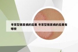 寻常型银屑病的后果 寻常型银屑病的后果有哪些