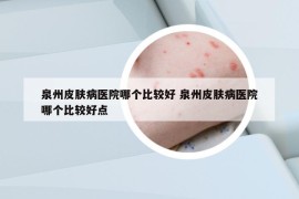 泉州皮肤病医院哪个比较好 泉州皮肤病医院哪个比较好点