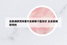 皮肤病研究所看牛皮癣哪个医生好 去皮肤病研究所