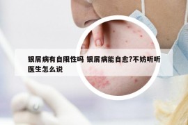 银屑病有自限性吗 银屑病能自愈?不妨听听医生怎么说