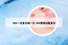 308一次多少钱一次 308费用大概多少