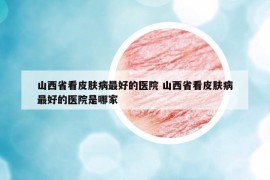 山西省看皮肤病最好的医院 山西省看皮肤病最好的医院是哪家