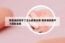 银屑病疙瘩平了怎么都是白圈 银屑病疙瘩平了颜色变黑