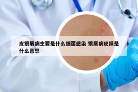 皮银屑病主要是什么细菌感染 银屑病皮损是什么意思