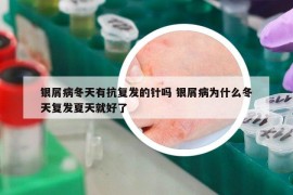 银屑病冬天有抗复发的针吗 银屑病为什么冬天复发夏天就好了