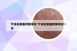 宁波皮肤医院哪家好 宁波皮肤医院哪家好一点