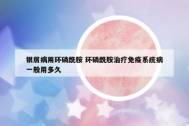 银屑病用环磷酰胺 环磷酰胺治疗免疫系统病一般用多久