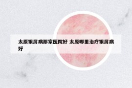 太原银屑病那家医院好 太原哪里治疗银屑病好
